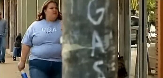 Obesidade a causa das varices