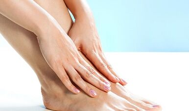Varices das extremidades inferiores