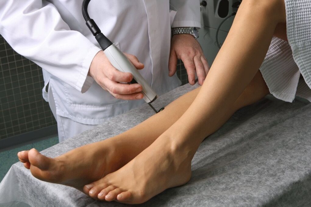 Tratamento das varices por un flebólogo